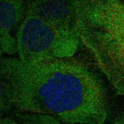 Immunocytochemistry/ Immunofluorescence: RANK/TNFRSF11A Antibody [NBP2-57044]