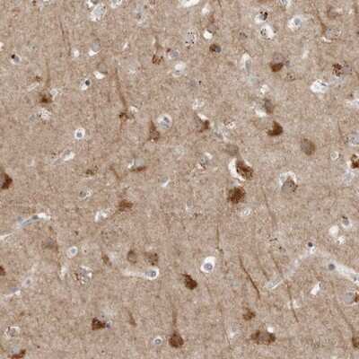 Immunohistochemistry-Paraffin: RANK/TNFRSF11A Antibody [NBP1-85771]