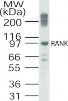 Western Blot: RANK/TNFRSF11A Antibody [NB100-56396]