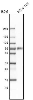 Western Blot: RANK/TNFRSF11A Antibody [NBP1-85771]