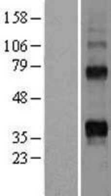 Western Blot: TRANCE/TNFSF11/RANK L Overexpression Lysate [NBL1-17162]