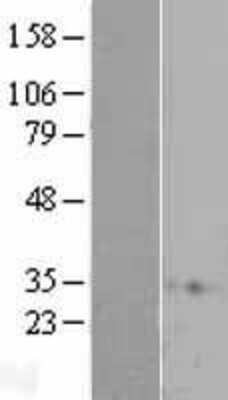 Western Blot: RAP1A Overexpression Lysate [NBL1-15145]