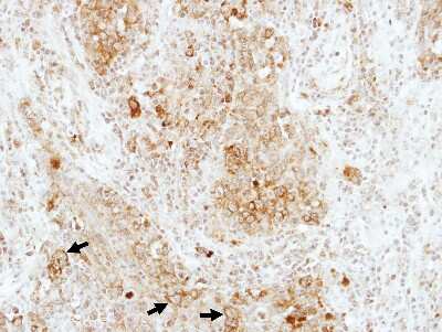 Immunohistochemistry-Paraffin: RAP1B Antibody [NBP2-20072]