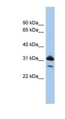 Western Blot: RAP1B Antibody [NBP1-54871]