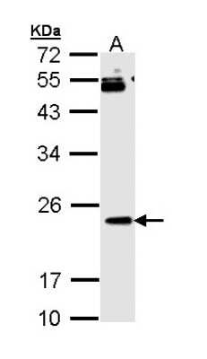 Western Blot: RAP1B Antibody [NBP2-20071]