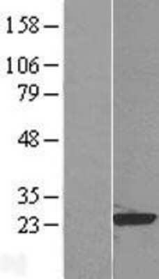 Western Blot: RAP1B Overexpression Lysate [NBL1-15147]