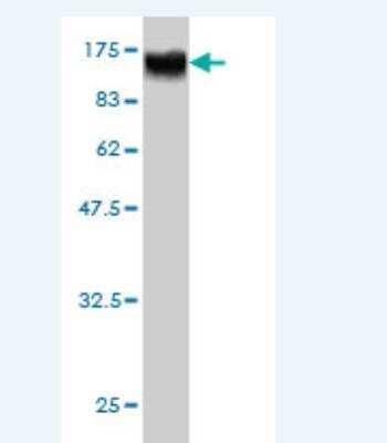 Western Blot: RAP1GAP Antibody (2F7) [H00005909-M01]