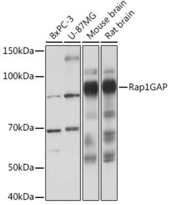 Western Blot: RAP1GAP Antibody (8V9I6) [NBP3-16234]