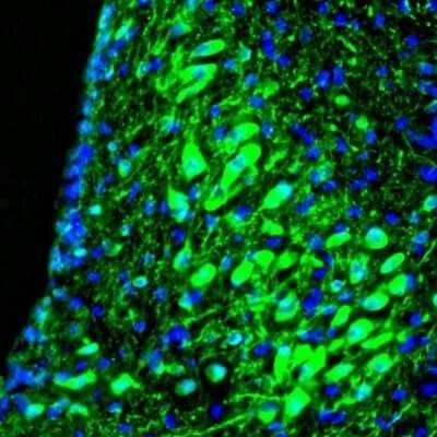 Immunohistochemistry: RAP1GAP Antibody [NBP1-83002]