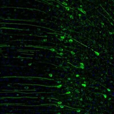 Immunohistochemistry: RAP1GAP Antibody [NBP1-83002]