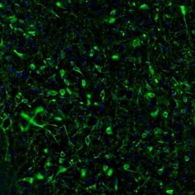 Immunohistochemistry: RAP1GAP Antibody [NBP1-83002]