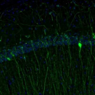 Immunohistochemistry: RAP1GAP Antibody [NBP1-83002]