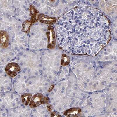 Immunohistochemistry-Paraffin: RAP1GAP Antibody [NBP1-83002]