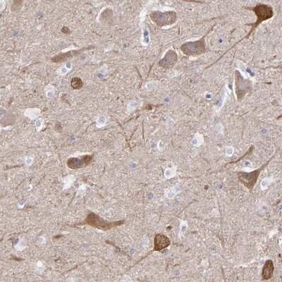 Immunohistochemistry-Paraffin: RAP1GAP Antibody [NBP1-83002]