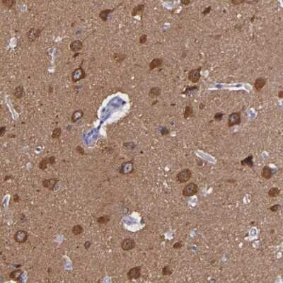 Immunohistochemistry-Paraffin: RAP1GAP Antibody [NBP1-83002]
