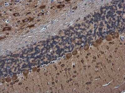 Immunohistochemistry-Paraffin: RAP1GAP Antibody [NBP3-13216]