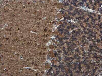 Immunohistochemistry-Paraffin: RAP1GAP Antibody [NBP3-13216]