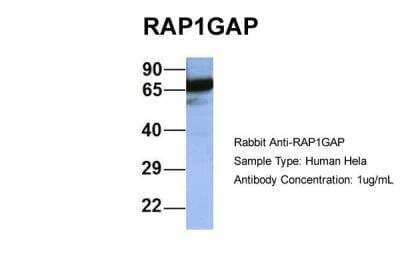 SDS-PAGE: RAP1GAP Antibody [NBP1-53072]