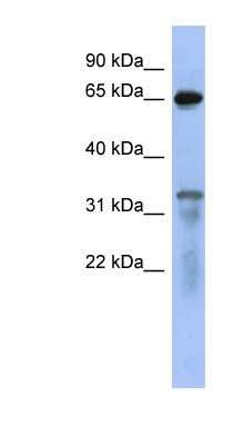 Western Blot: RAP1GAP Antibody [NBP1-53072]