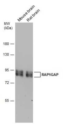 Western Blot: RAP1GAP Antibody [NBP3-13211]