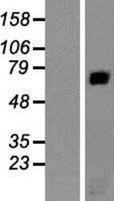 Western Blot: RAP1GAP Overexpression Lysate [NBP2-08058]