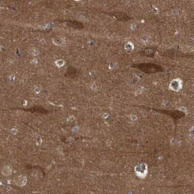 Immunohistochemistry-Paraffin: RAP1GAP2 Antibody [NBP1-93720]