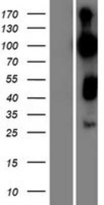 Western Blot: RAP1GAP2 Overexpression Lysate [NBP2-07198]