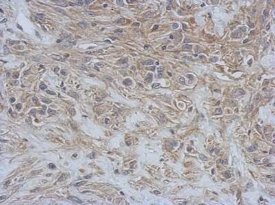 Immunohistochemistry-Paraffin: RAP1GDS1 Antibody [NBP2-20073]