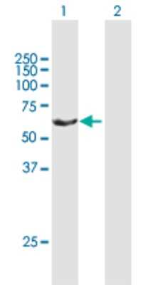 Western Blot: RAP1GDS1 Antibody [H00005910-B01P]