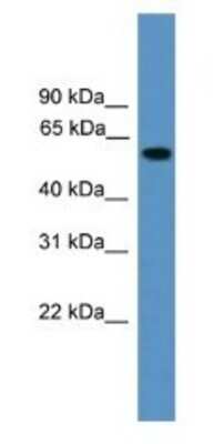 Western Blot: RAP1GDS1 Antibody [NBP1-69099]