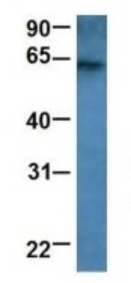 Western Blot: RAP1GDS1 Antibody [NBP1-69099]