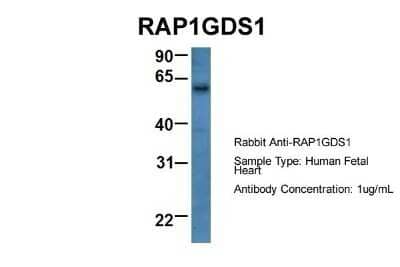 Western Blot: RAP1GDS1 Antibody [NBP1-69099]