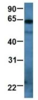 Western Blot: RAP1GDS1 Antibody [NBP1-69099]