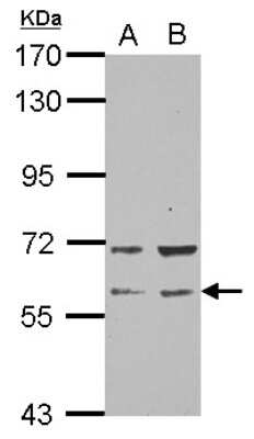 Western Blot: RAP1GDS1 Antibody [NBP2-20073]