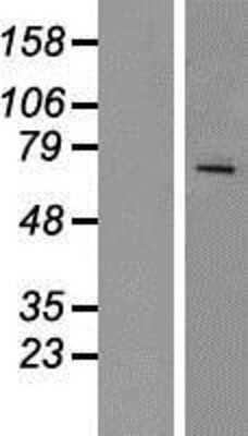 Western Blot: RAP1GDS1 Overexpression Lysate [NBP2-06554]