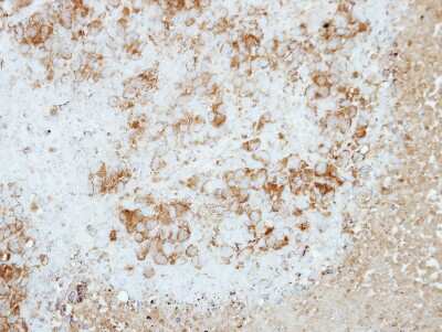 Immunohistochemistry-Paraffin: Rap2B Antibody [NBP2-20075]