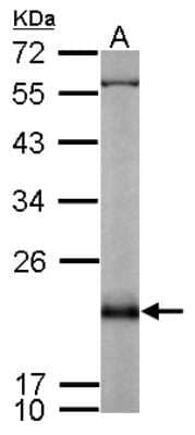 Western Blot: Rap2B Antibody [NBP2-20075]