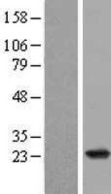 Western Blot: Rap2B Overexpression Lysate [NBL1-15149]