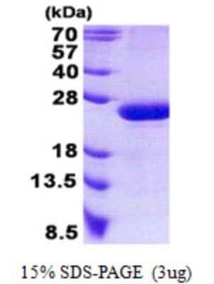 SDS-PAGE: Recombinant Human Rap2B His Protein [NBP2-23396]