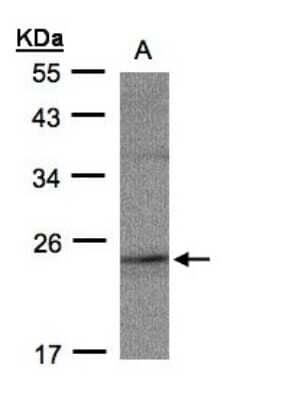 Western Blot: RAP2C Antibody [NBP1-32435]