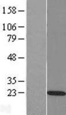 Western Blot: RAP2C Overexpression Lysate [NBL1-15150]