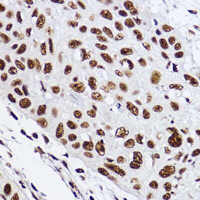 Immunohistochemistry-Paraffin: RAP30 Antibody (3T7Q9) [NBP3-15275]