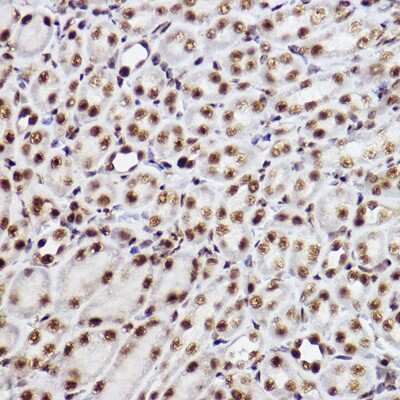 Immunohistochemistry-Paraffin: RAP30 Antibody (3T7Q9) [NBP3-15275]