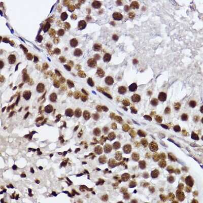 Immunohistochemistry-Paraffin: RAP30 Antibody (3T7Q9) [NBP3-15275]