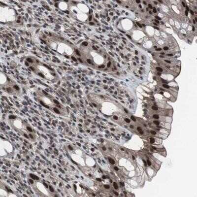 Immunohistochemistry: RAP30 Antibody [NBP3-17973]