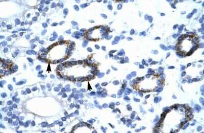 Immunohistochemistry: RAP30 Antibody [NBP3-17978]