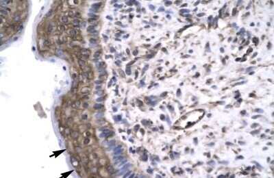 Immunohistochemistry: RAP30 Antibody [NBP3-17979]