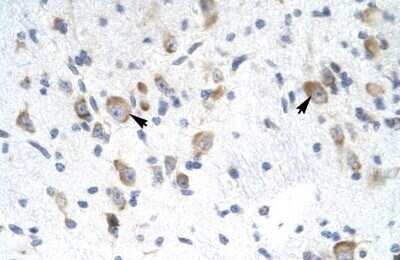 Immunohistochemistry: RAP30 Antibody [NBP3-17980]