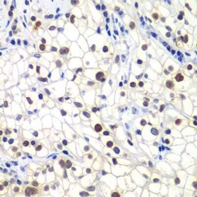 Immunohistochemistry: RAP30 Antibody - BSA Free [NBP3-17982]