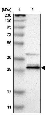 Western Blot: RAP30 Antibody [NBP3-17973]